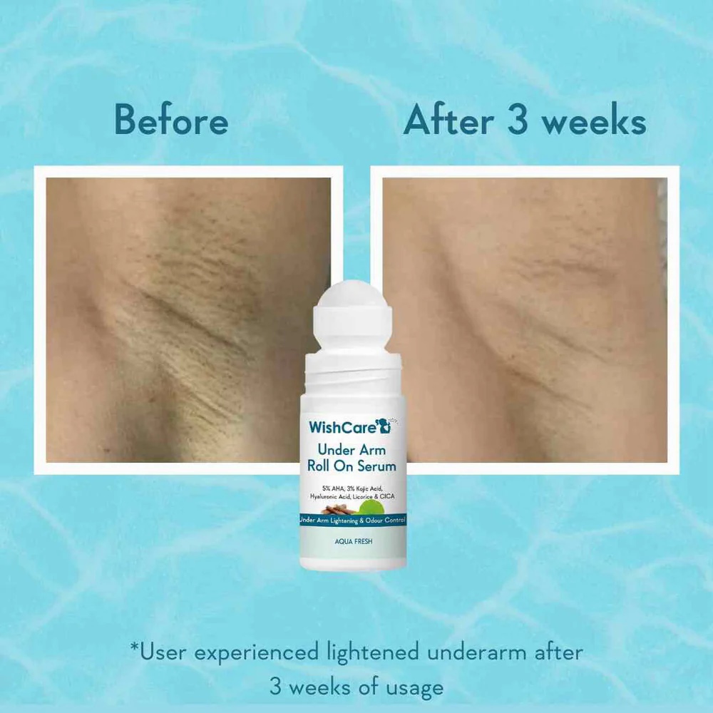 wishcare under arm roll on serum 50ml 7